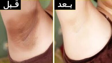 كريم تبيض المناطق الحساسة