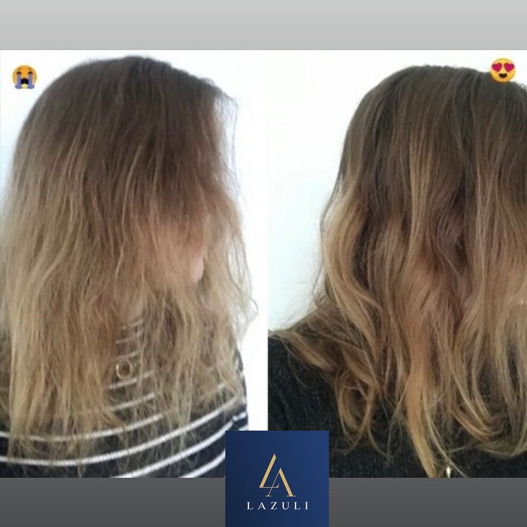 زيت الشعر لازولي - عشر زيوت طبيعيه ٠ رقم ١ في انبات البيبي هاير