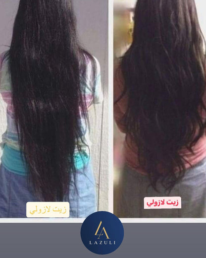 زيت الشعر لازولي - عشر زيوت طبيعيه ٠ رقم ١ في انبات البيبي هاير